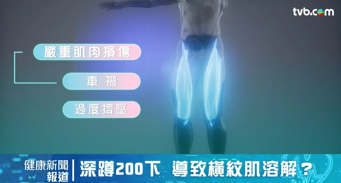 7f230d3b-0aad-430c-8bad-d3b9d084b362.png.webp