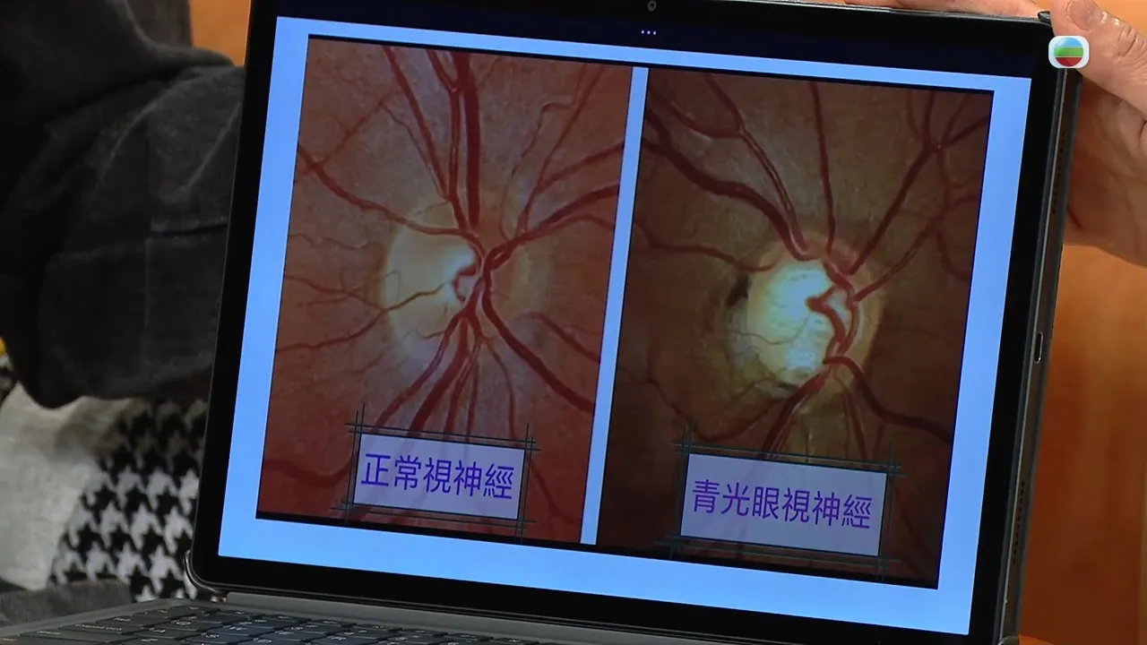 c3fda19e-b088-4242-bb8a-5cdf0ea012ce.jpg.webp