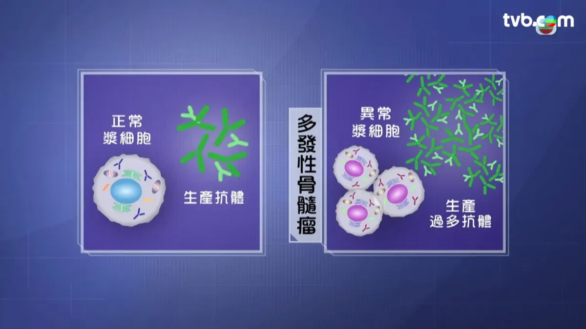 ea820fcf-a1ba-4b71-a8c0-2d28f78cf18e.jpg.webp