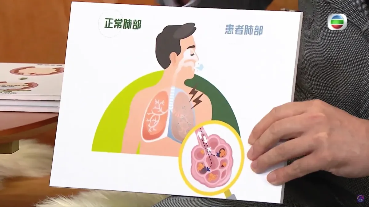 16f3847e-9c39-459d-aad4-8dae59895c85.png.webp