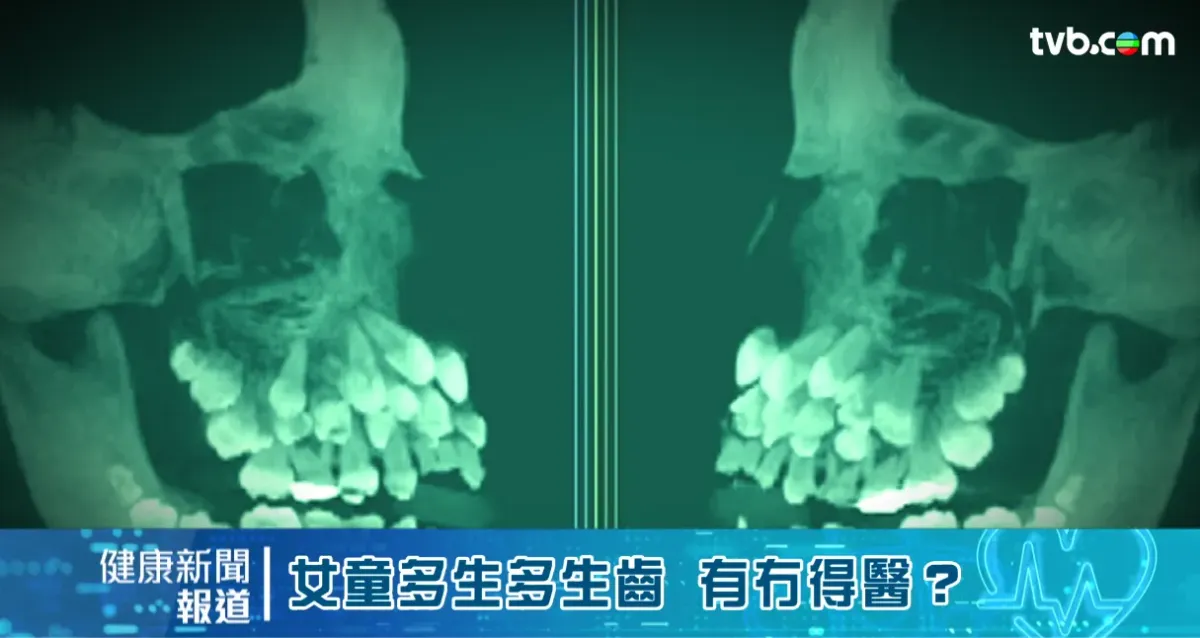 0081fd54-8ecd-464e-ada8-ca217dbe6772.png.webp