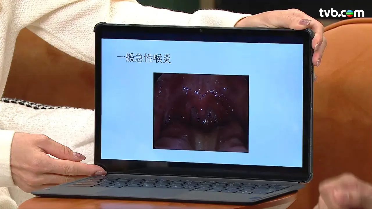 9d28fcd4-b9c4-4e2d-ab32-1b3fb9545e6e.jpg.webp
