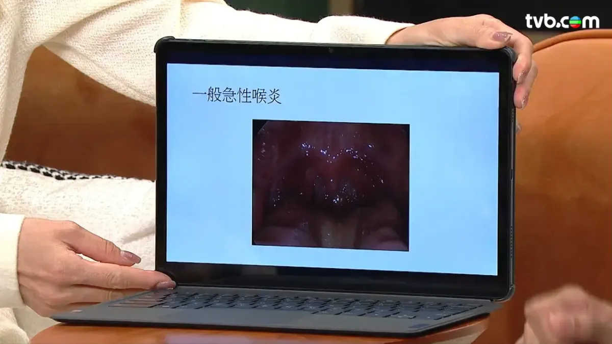 9d28fcd4-b9c4-4e2d-ab32-1b3fb9545e6e.jpg.webp