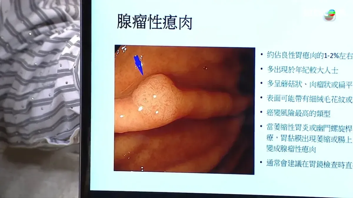 9627a1a3-d3ad-4b7f-a27a-bbb285b8ddee.jpg.webp