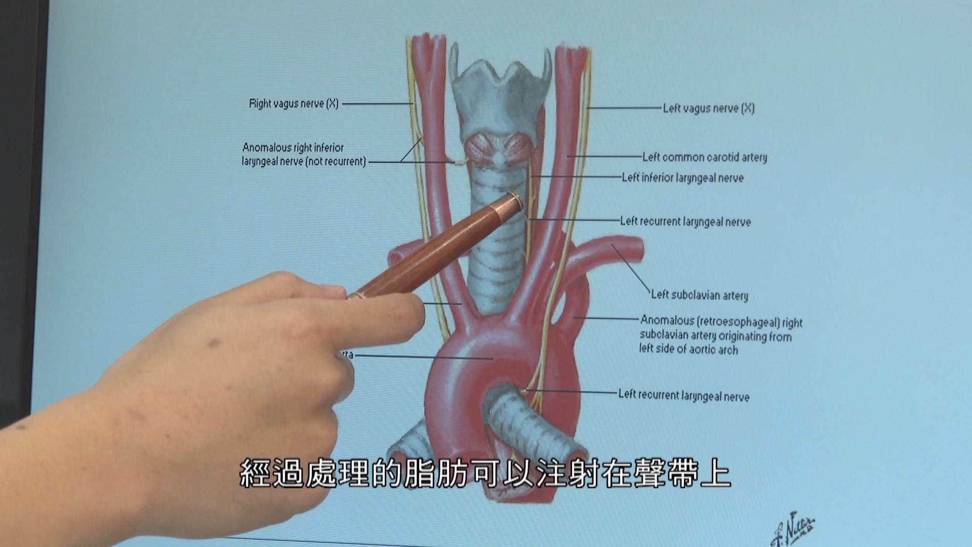 Picture_EP440 聲帶閉合不全 DOCTOR_003.jpg