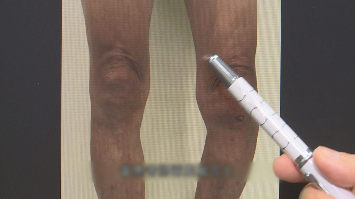 Picture_J.MEDIC.LEGS 2000.jpg
