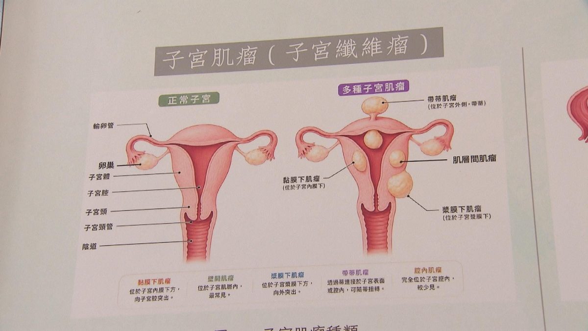 Picture_CC.J.CUHK-1600.jpg