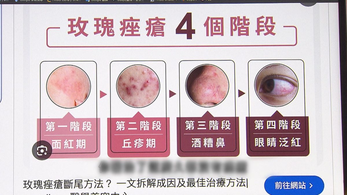 Picture_J.MEDIC.ACNE HOLD.jpg