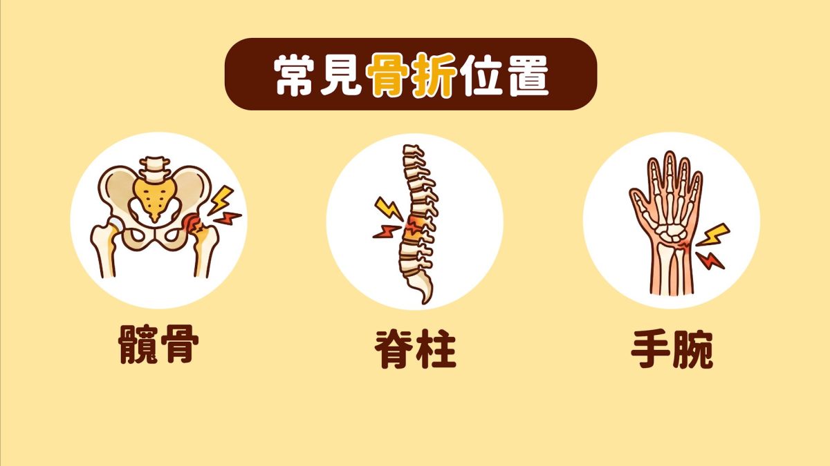 2. 常見的脆性骨折部位.jpeg