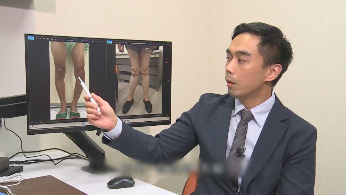 Picture_FOR APPS EP470 下肢變形(延伸閱讀配片)_001.jpg